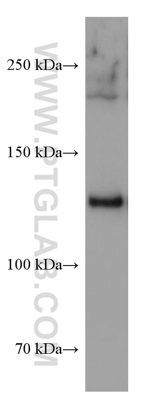 WB analysis of human placenta using 67288-1-Ig