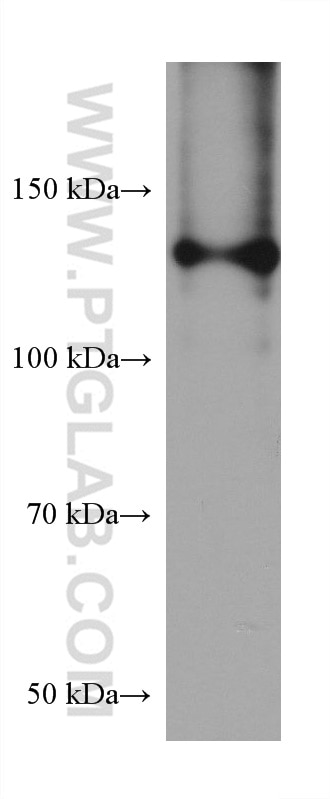 Western Blot (WB) analysis of pig lung tissue using Collagen Type I Monoclonal antibody (67288-1-Ig)