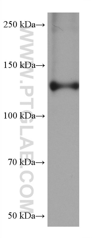 Western Blot (WB) analysis of pig skin tissue using Collagen Type I Monoclonal antibody (67288-1-Ig)