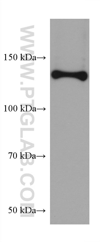 Western Blot (WB) analysis of pig colon tissue using Collagen Type I Monoclonal antibody (67288-1-Ig)