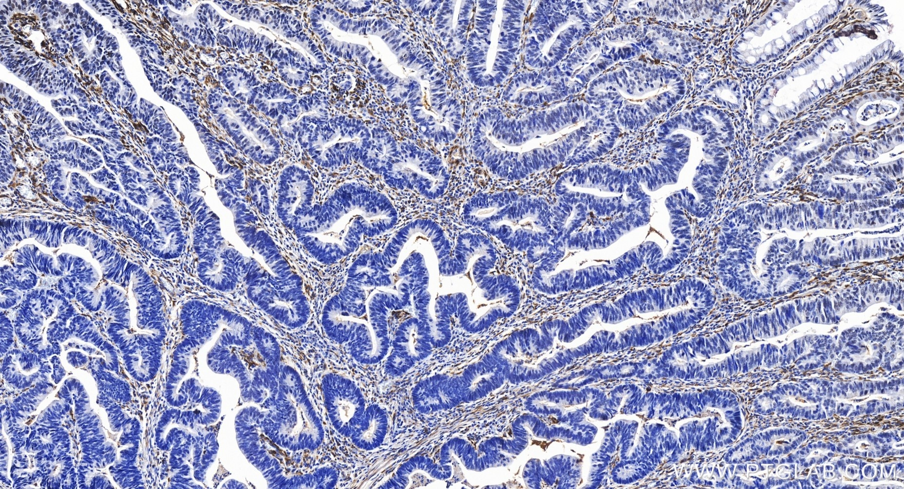 Collagen Type I