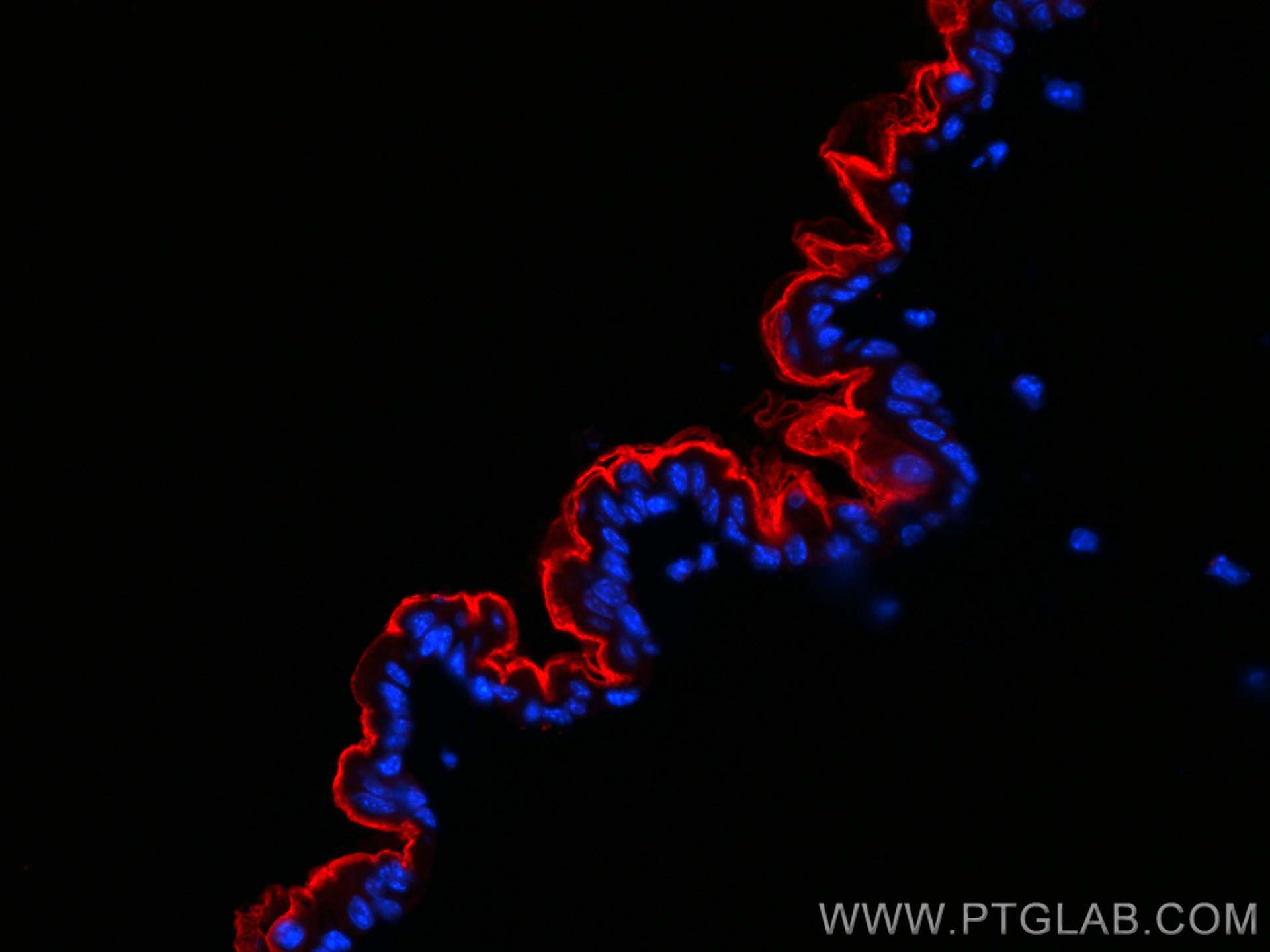 Immunofluorescence (IF) / fluorescent staining of mouse skin tissue using CoraLite®594-conjugated Collagen Type I Monoclonal (CL594-67288)