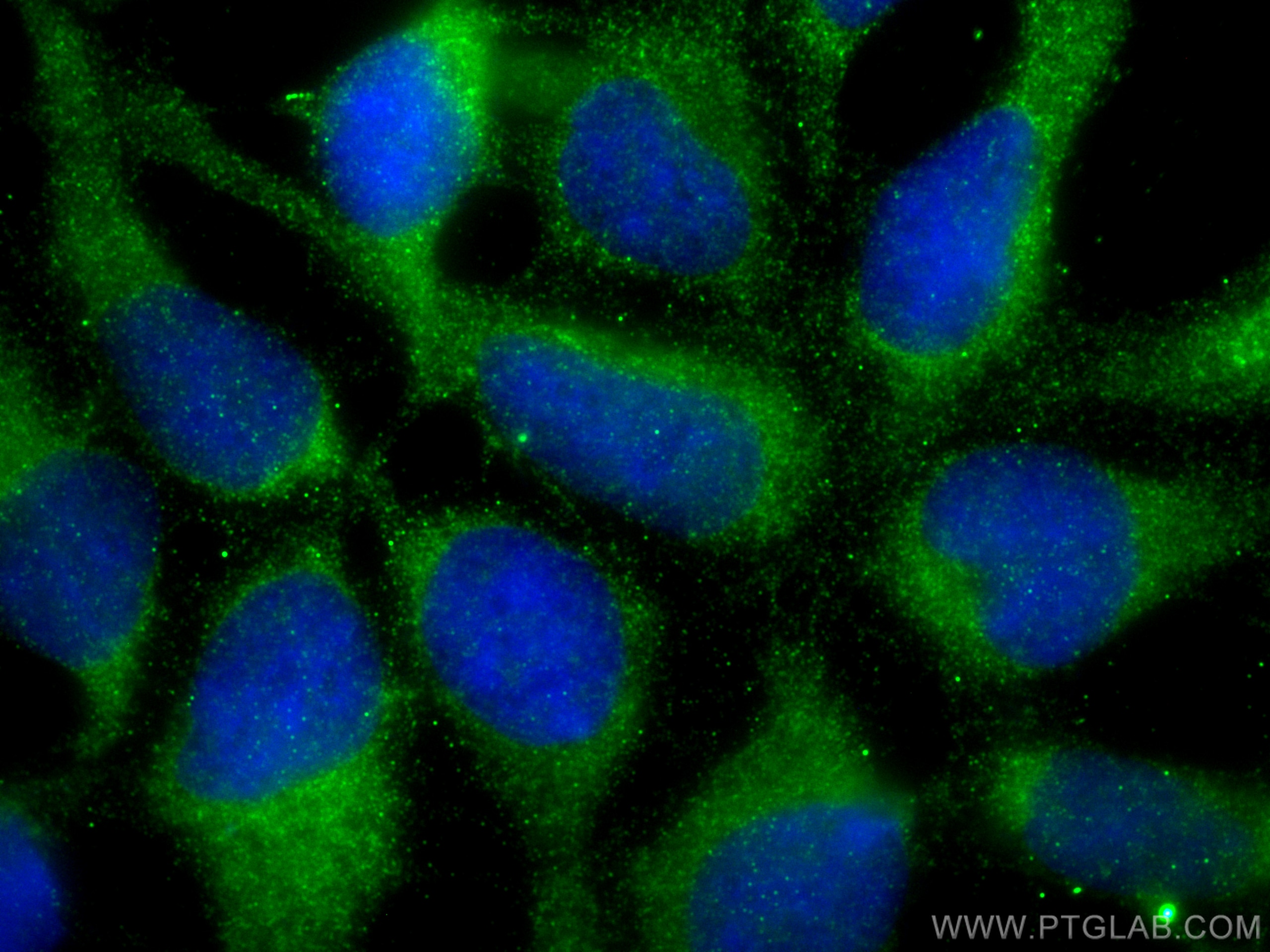 Collagen Type II