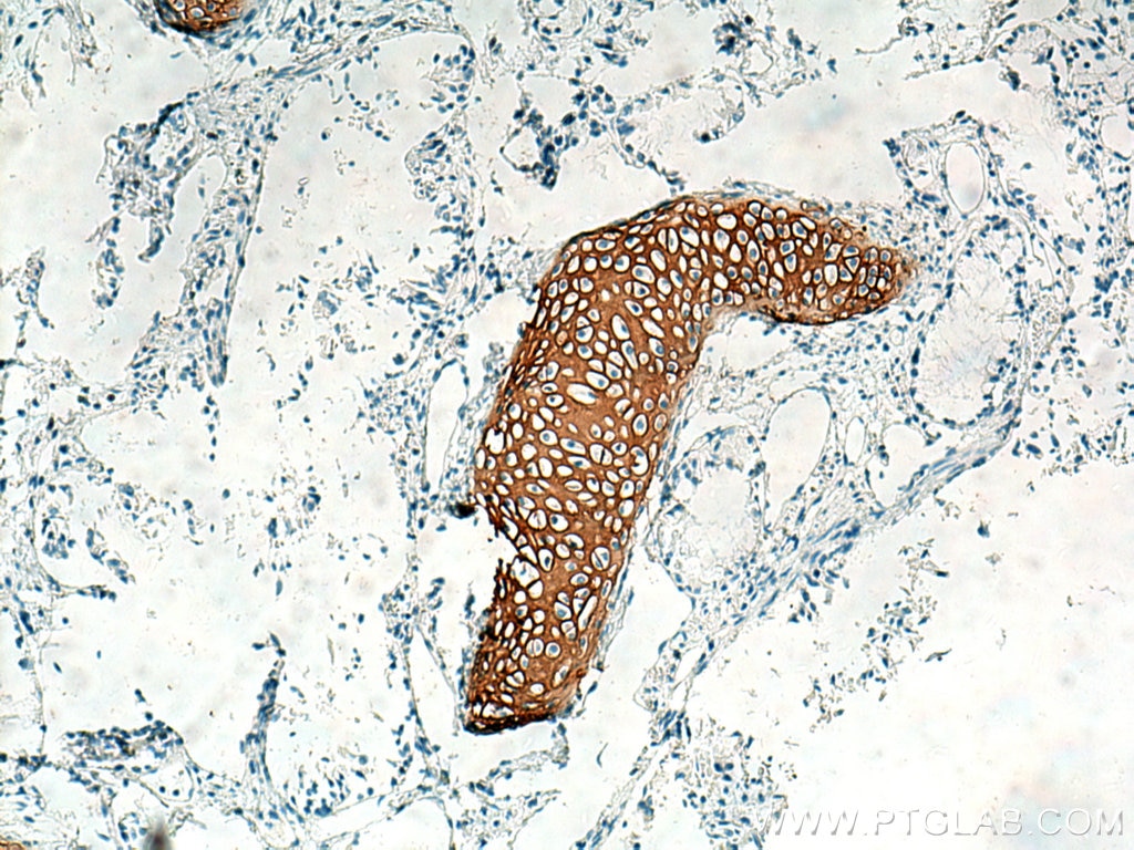 IHC staining of human lung using 28459-1-AP