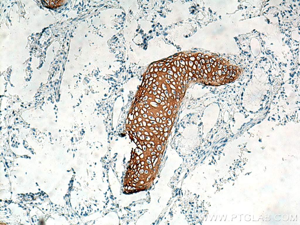 Immunohistochemistry (IHC) staining of human lung tissue using Collagen Type II Polyclonal antibody (28459-1-AP)