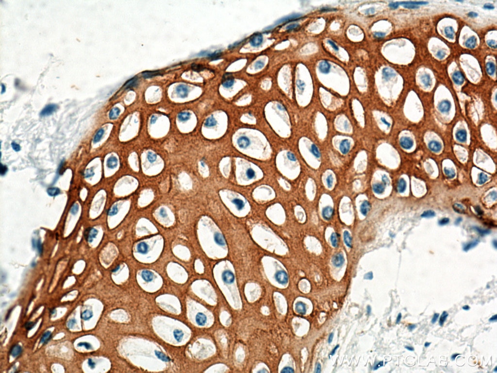 Immunohistochemistry (IHC) staining of human lung tissue using Collagen Type II Polyclonal antibody (28459-1-AP)