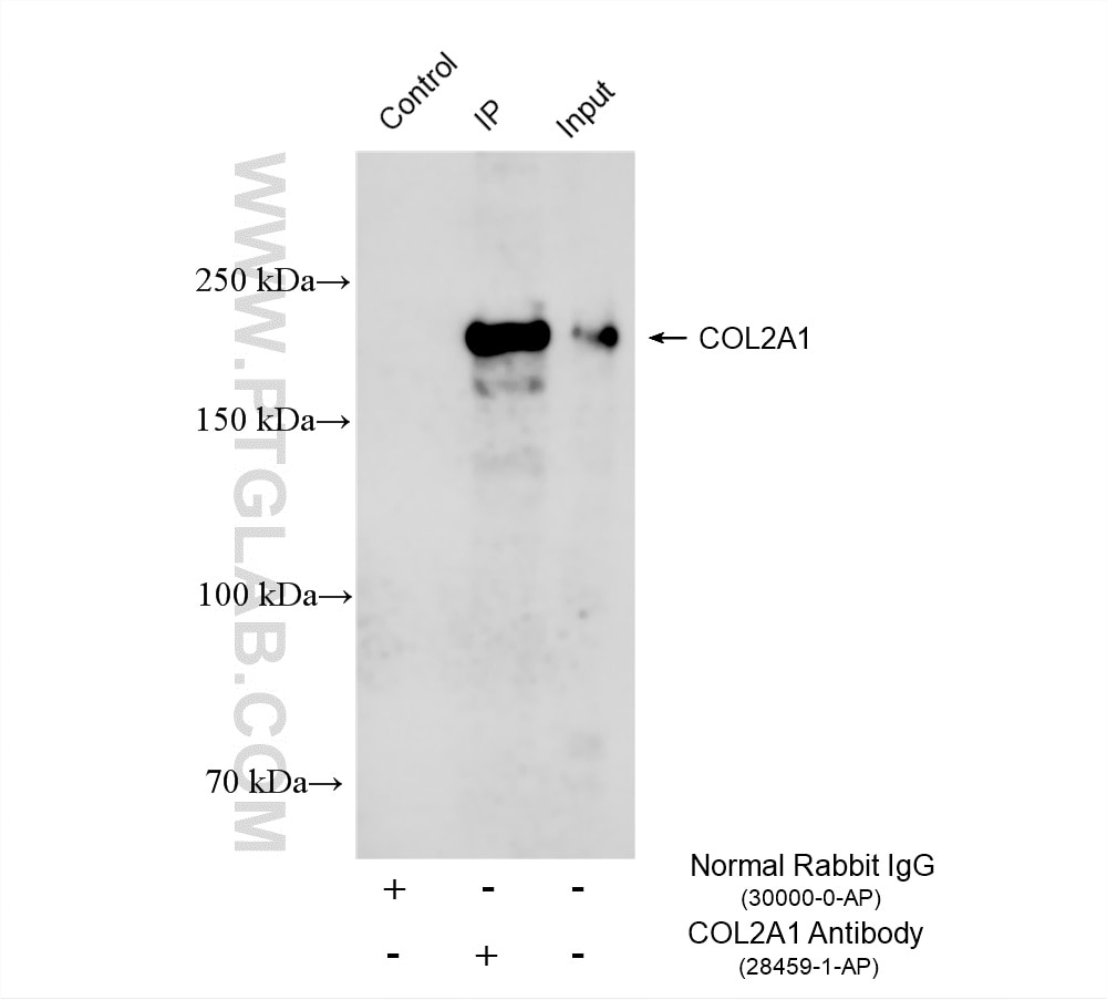 Immunoprecipitation (IP) experiment of TT cells using Collagen Type II Polyclonal antibody (28459-1-AP)