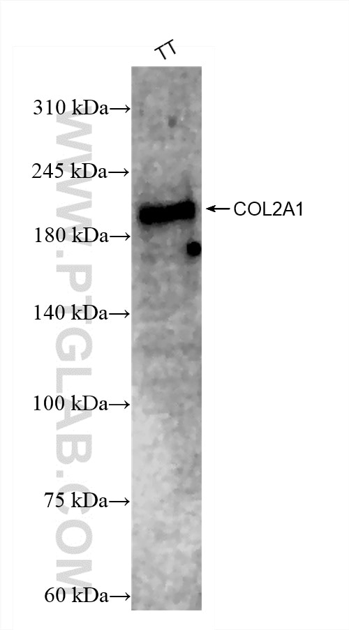Collagen Type II