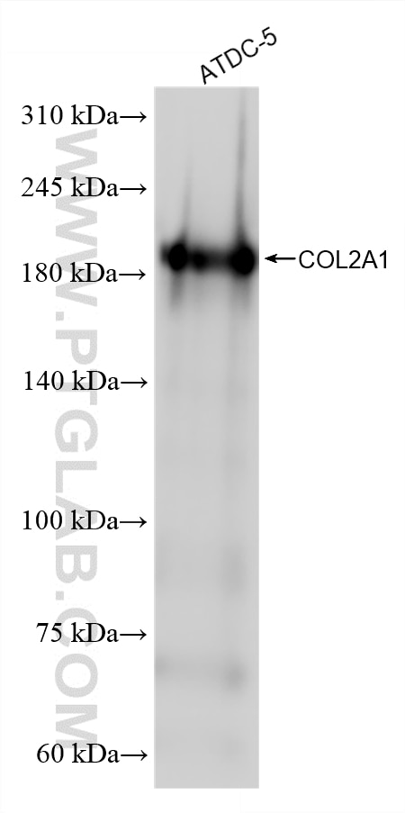 Western Blot (WB) analysis of various lysates using Collagen Type II Recombinant monoclonal antibody (86139-2-RR)
