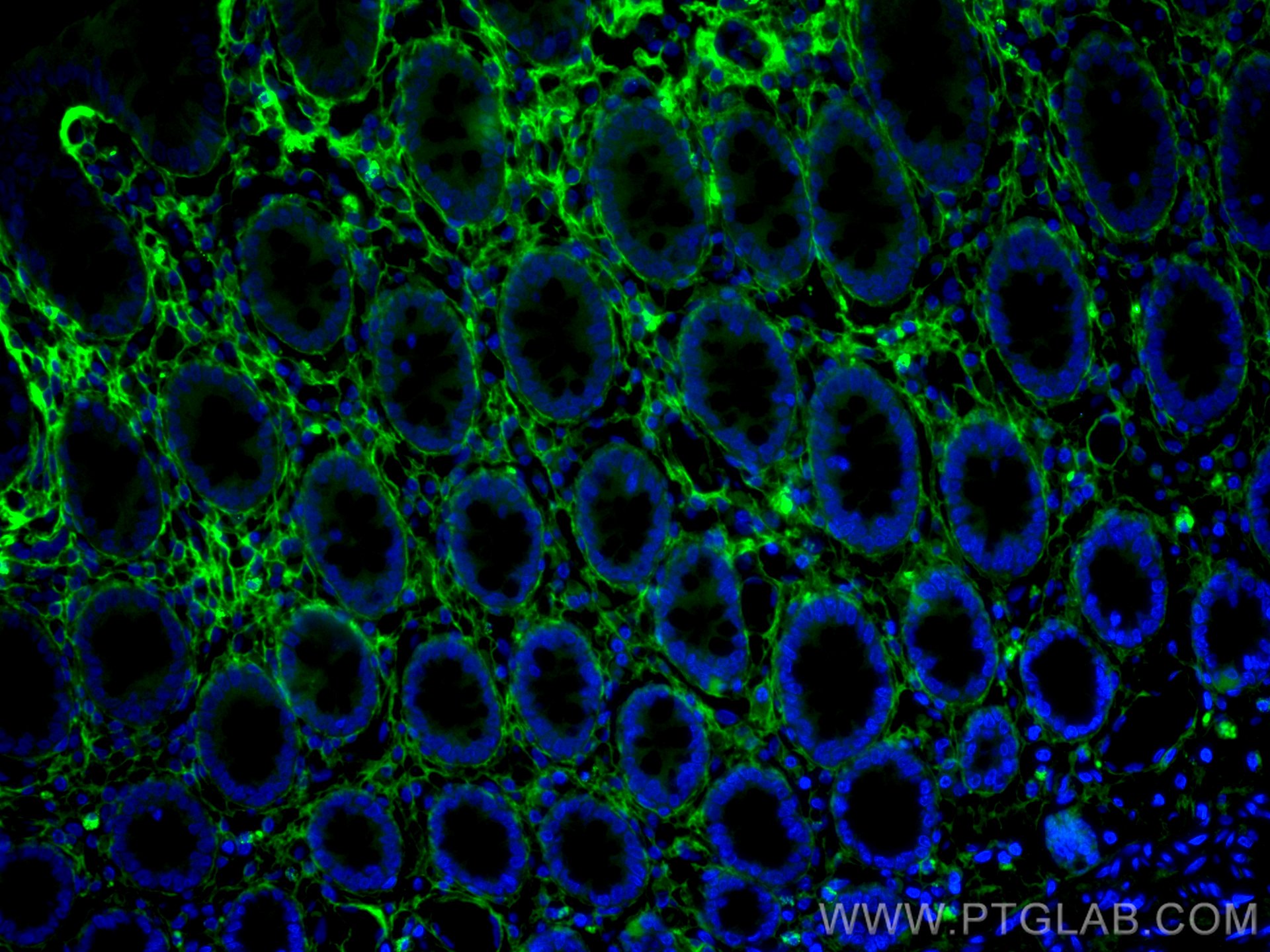 Immunofluorescence (IF) / fluorescent staining of human colon tissue using CoraLite® Plus 488-conjugated Collagen Type III (N (CL488-80009)