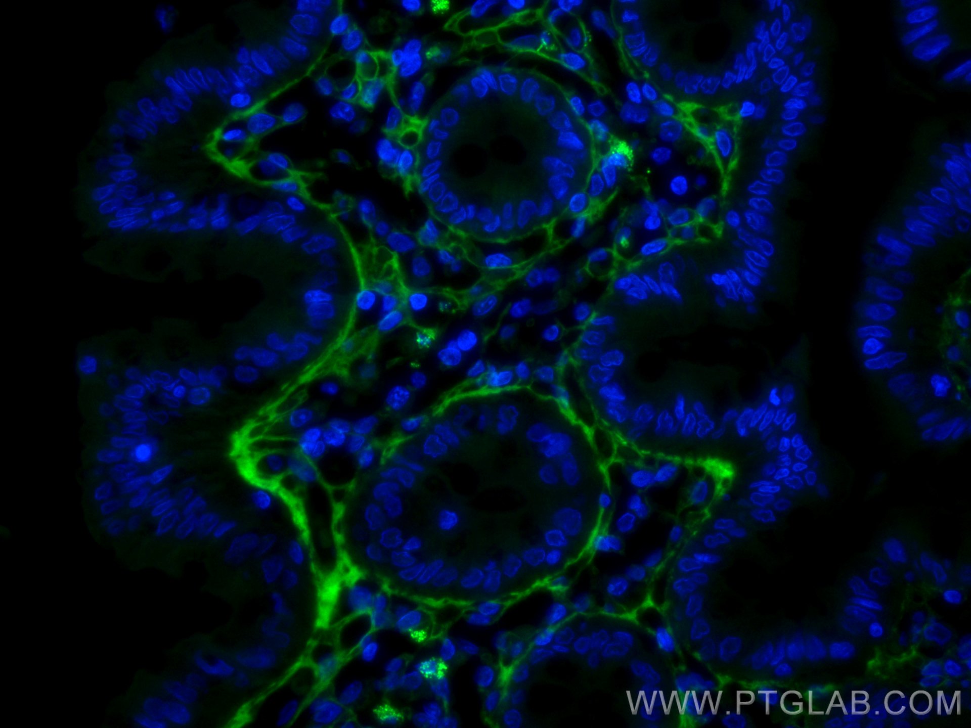 Immunofluorescence (IF) / fluorescent staining of human colon tissue using CoraLite® Plus 488-conjugated Collagen Type III (N (CL488-80009)