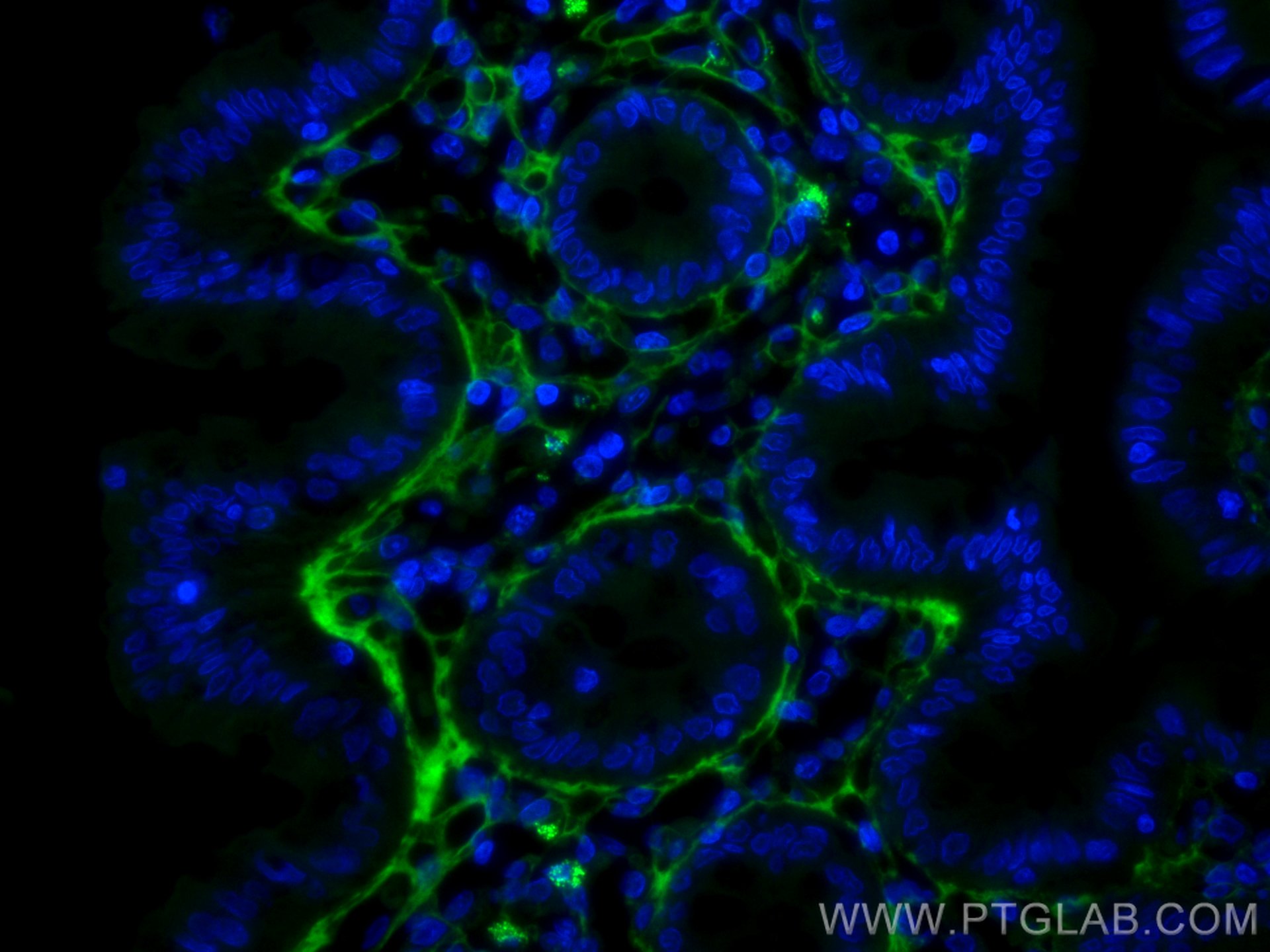 Collagen Type III (N-terminal)