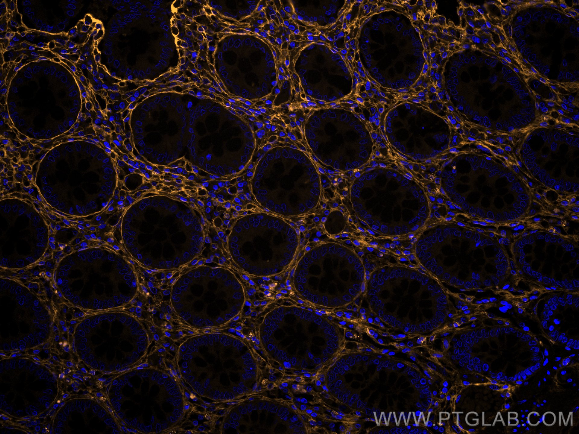 Immunofluorescence (IF) / fluorescent staining of human colon tissue using CoraLite®555-conjugated Collagen Type III (N-termi (CL555-80009)