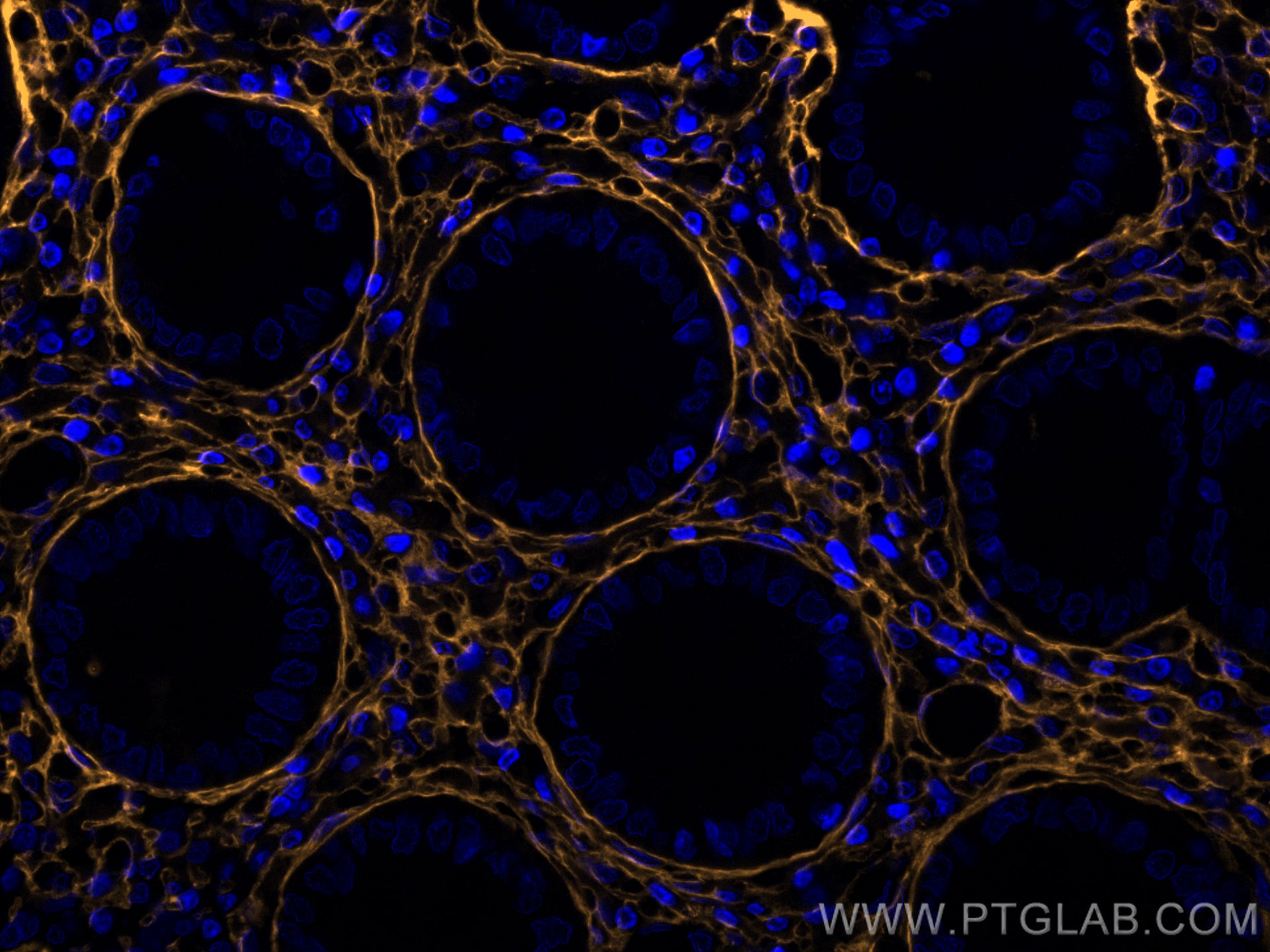 Immunofluorescence (IF) / fluorescent staining of human colon tissue using CoraLite®555-conjugated Collagen Type III (N-termi (CL555-80009)