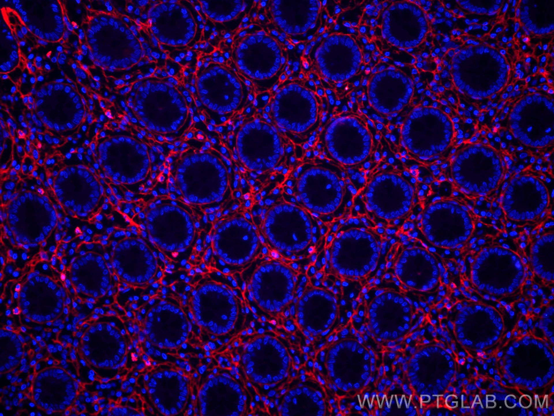 Immunofluorescence (IF) / fluorescent staining of human colon tissue using CoraLite®594-conjugated Collagen Type III (N-termi (CL594-80009)