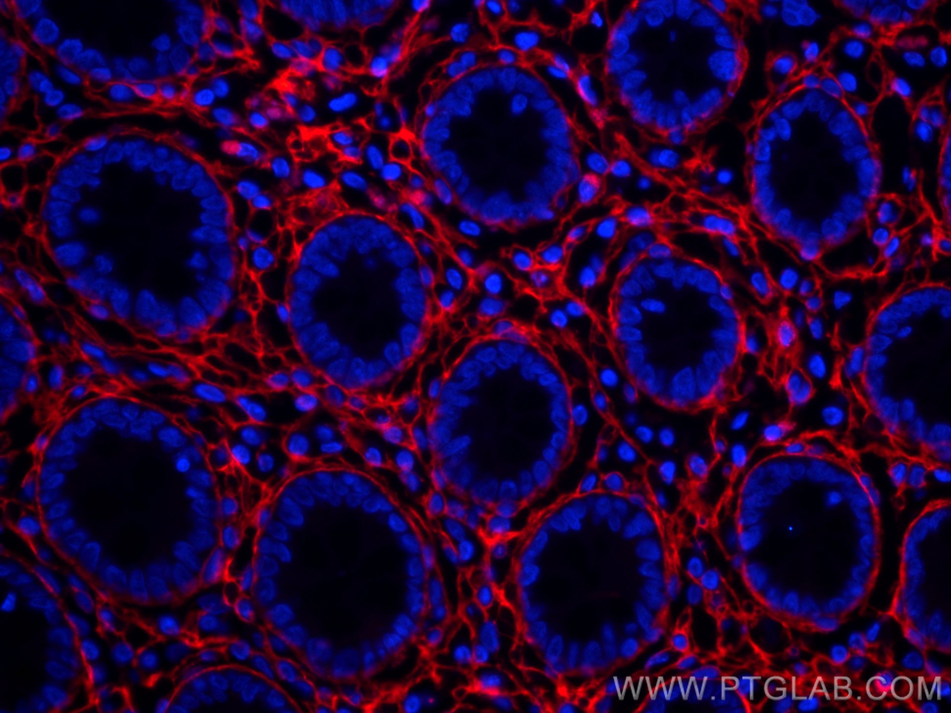 Immunofluorescence (IF) / fluorescent staining of human colon tissue using CoraLite®594-conjugated Collagen Type III (N-termi (CL594-80009)
