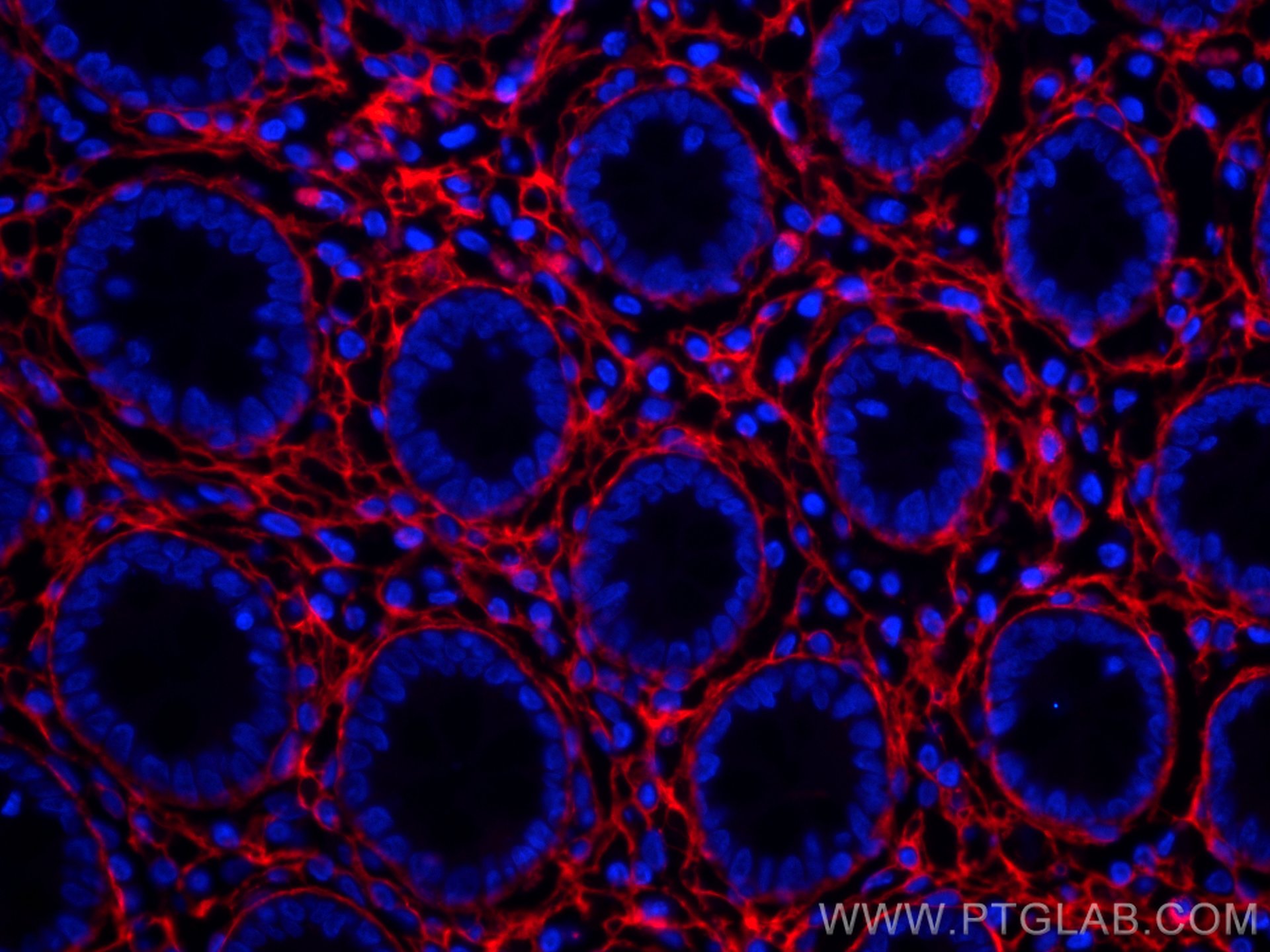 Collagen Type III (N-terminal)