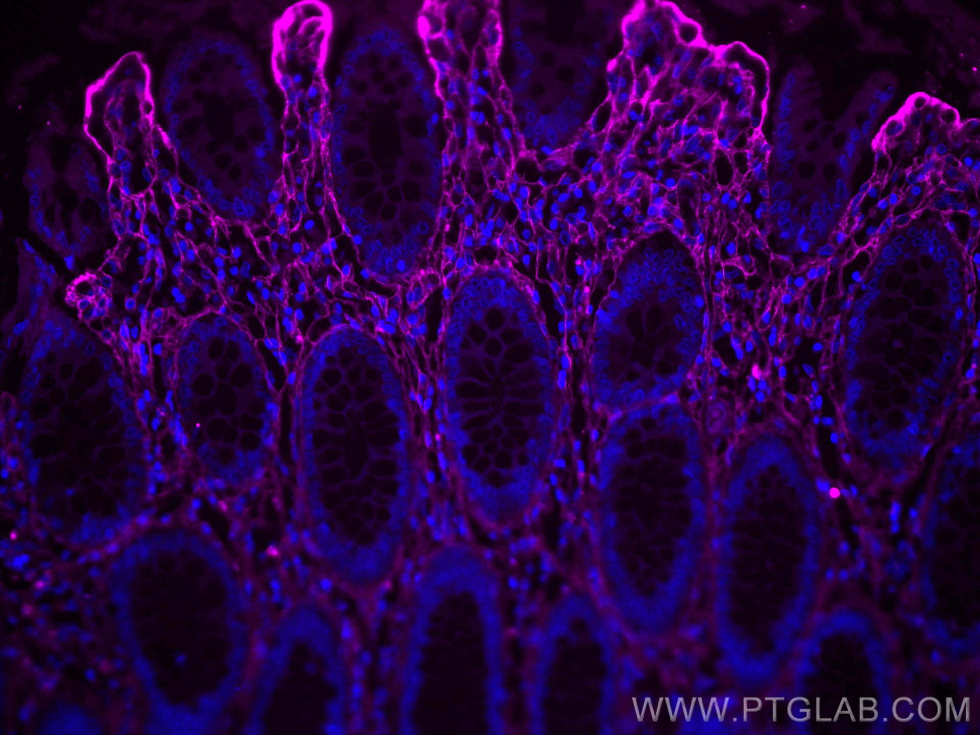 IF Staining of human colon using CL647-80009