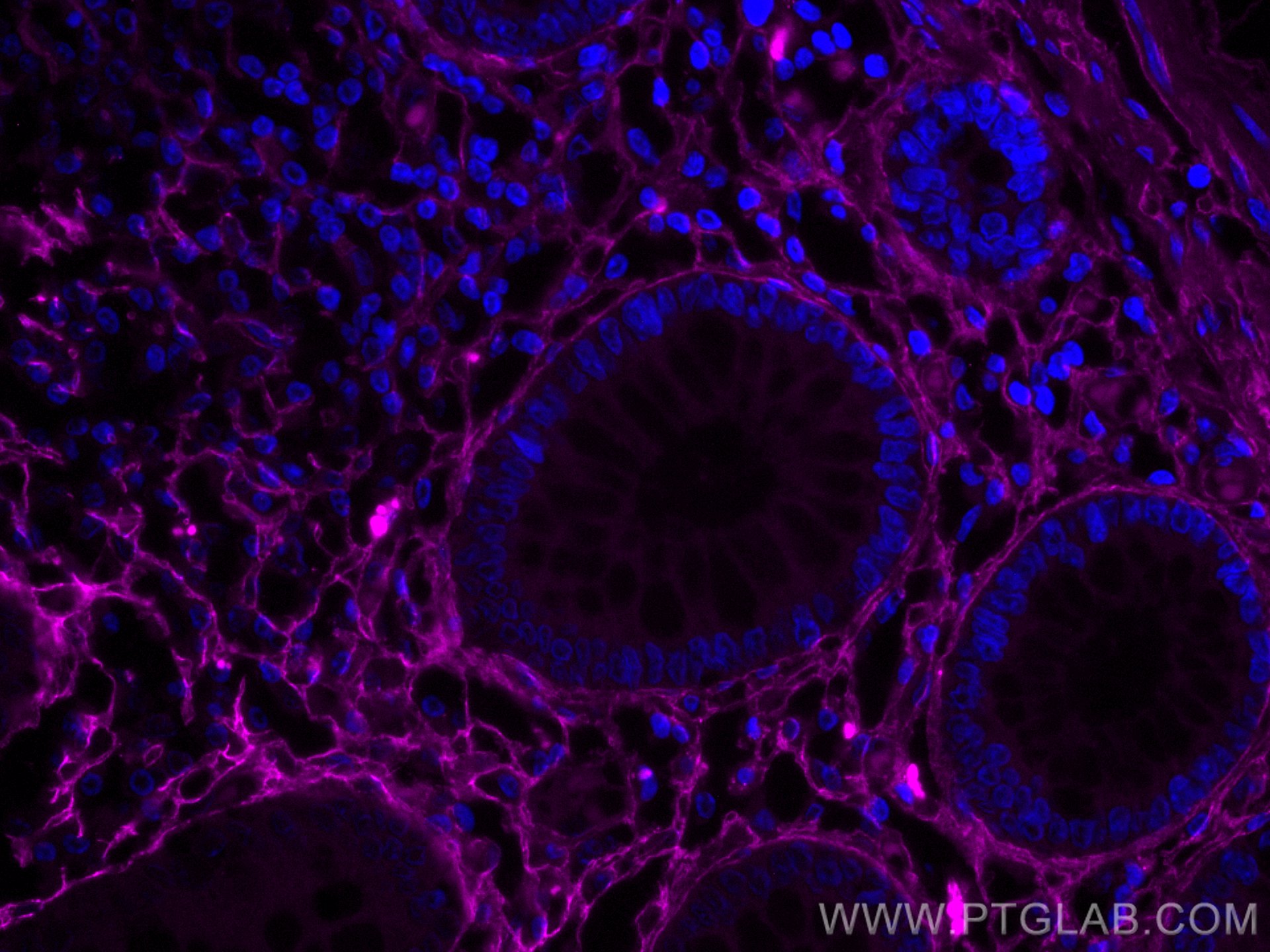 Immunofluorescence (IF) / fluorescent staining of human colon tissue using CoraLite® Plus 647-conjugated Collagen Type III (N (CL647-80009)