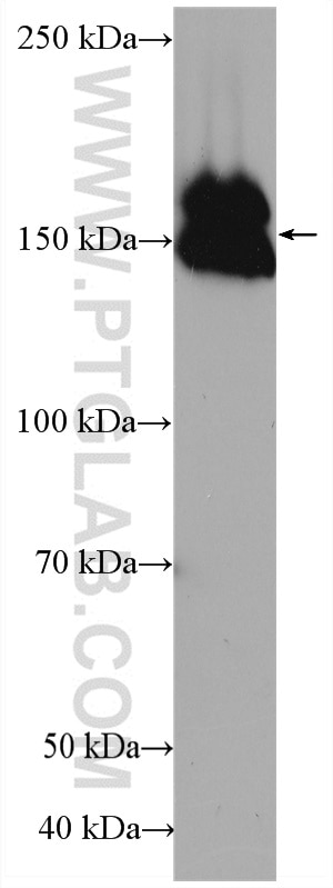 Western Blot (WB) analysis of rat skin tissue using HRP-conjugated Collagen Type III (N-terminal) Poly (HRP-22734)