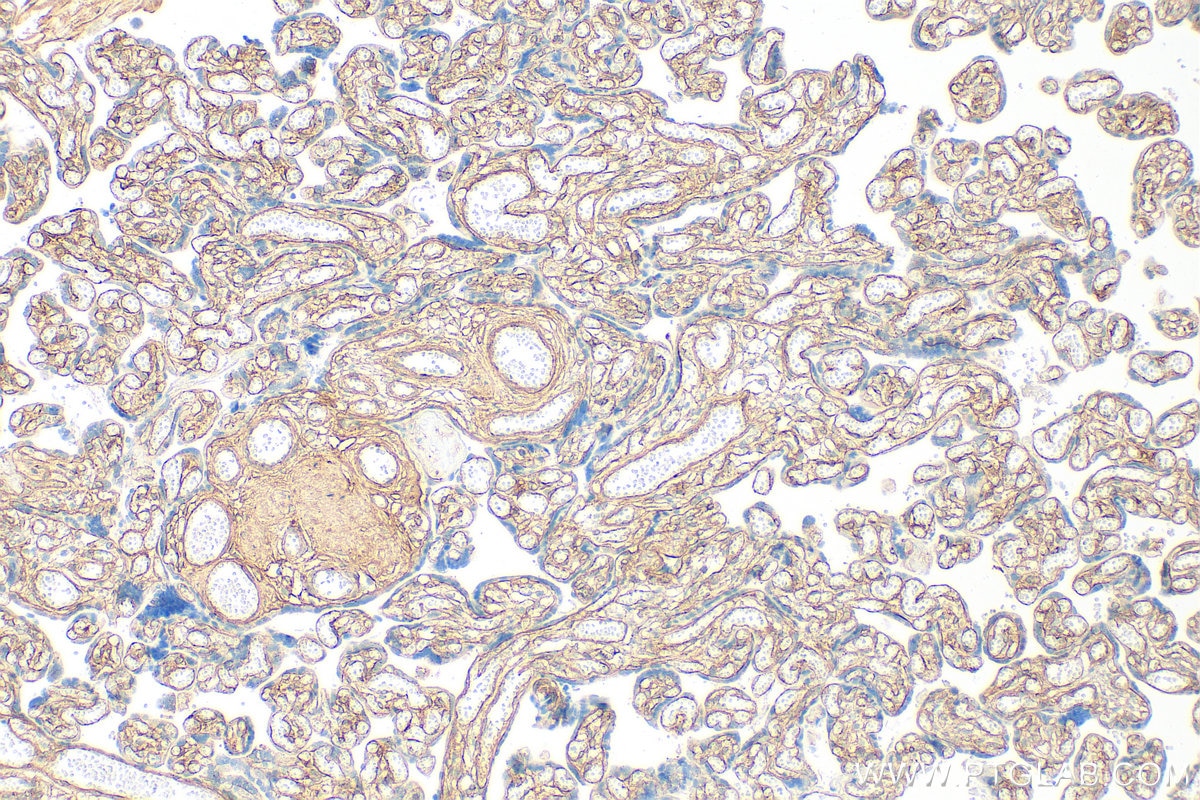 Immunohistochemistry (IHC) staining of human placenta tissue using Collagen Type IV Polyclonal antibody (30850-1-AP)