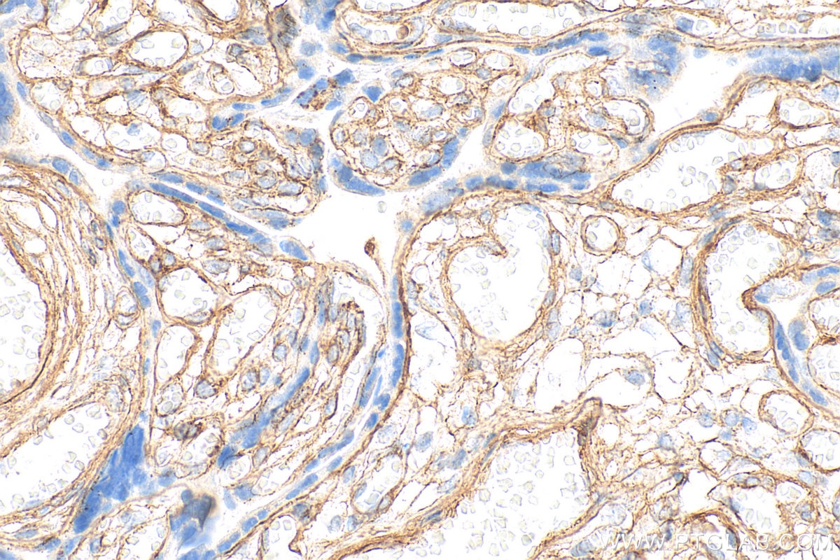 Immunohistochemistry (IHC) staining of human placenta tissue using Collagen Type IV Polyclonal antibody (30850-1-AP)