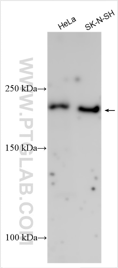 Western Blot (WB) analysis of various lysates using Collagen Type IV Polyclonal antibody (30850-1-AP)