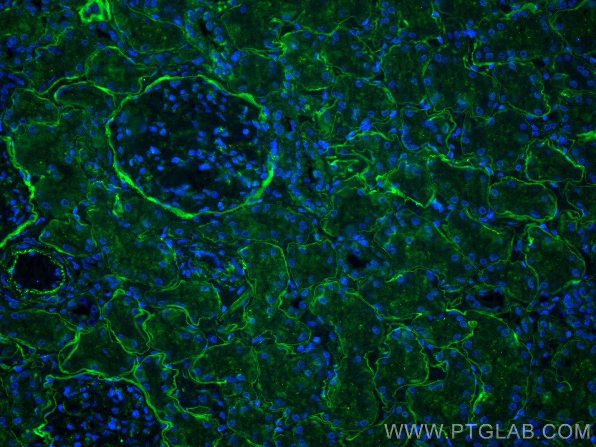 Immunofluorescence (IF) / fluorescent staining of human kidney tissue using COL4A2-specific Polyclonal antibody (55131-1-AP)