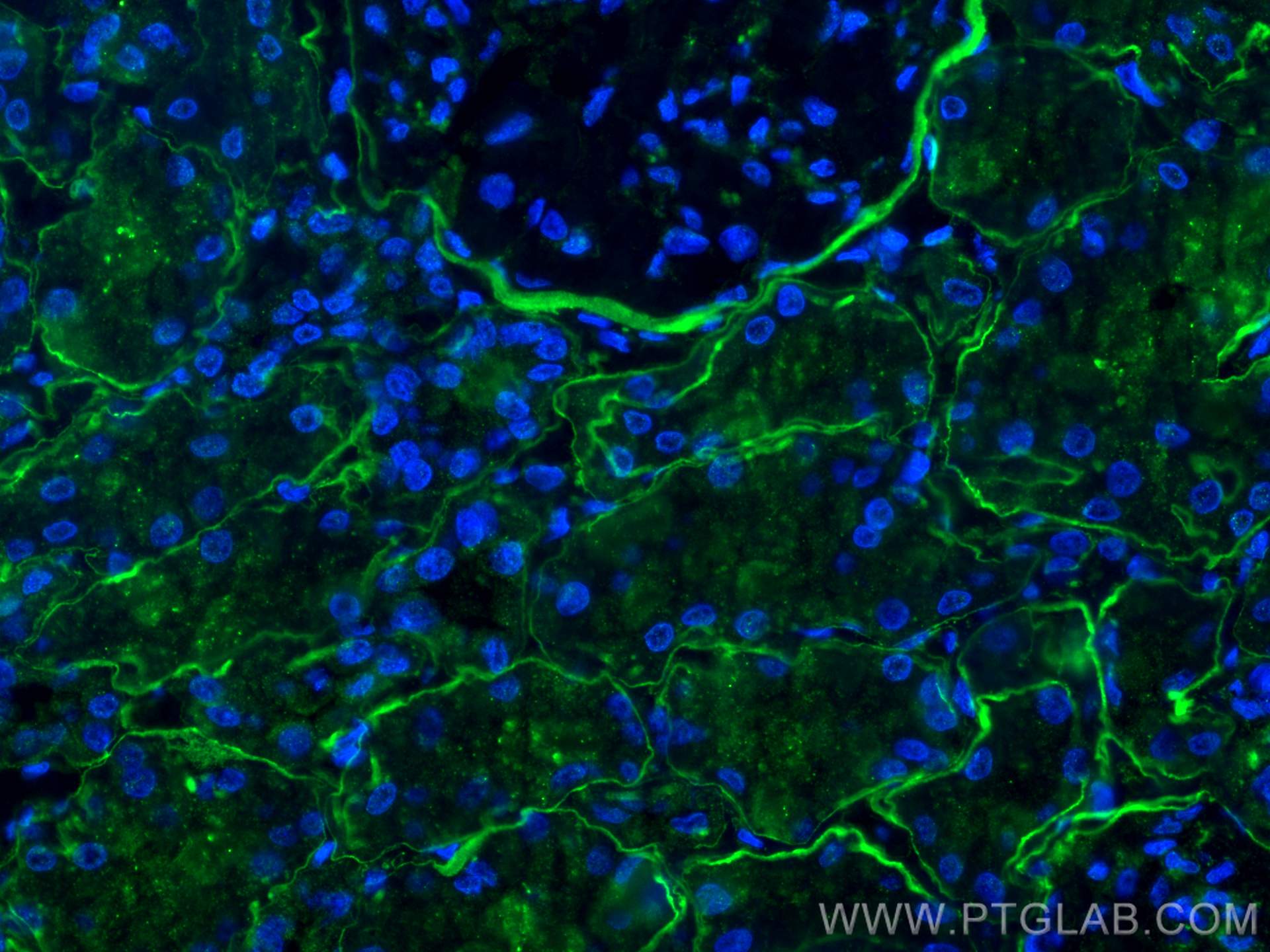 Immunofluorescence (IF) / fluorescent staining of human kidney tissue using COL4A2-specific Polyclonal antibody (55131-1-AP)