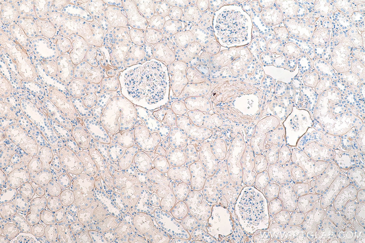 Immunohistochemistry (IHC) staining of human kidney tissue using COL4A2-specific Polyclonal antibody (55131-1-AP)