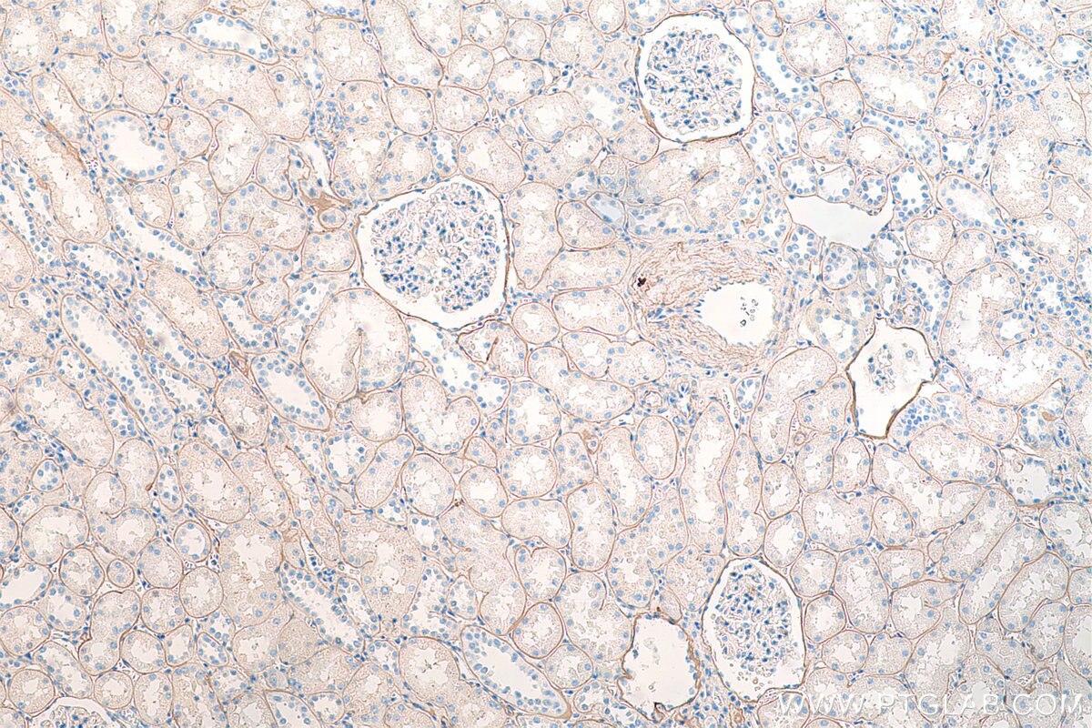 Immunohistochemistry (IHC) staining of human kidney tissue using COL4A2-specific Polyclonal antibody (55131-1-AP)