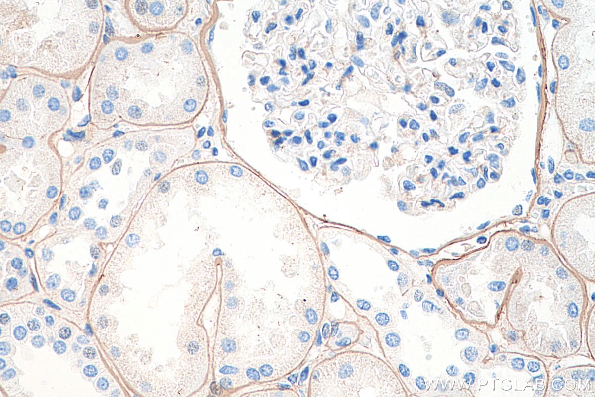 Immunohistochemistry (IHC) staining of human kidney tissue using COL4A2-specific Polyclonal antibody (55131-1-AP)