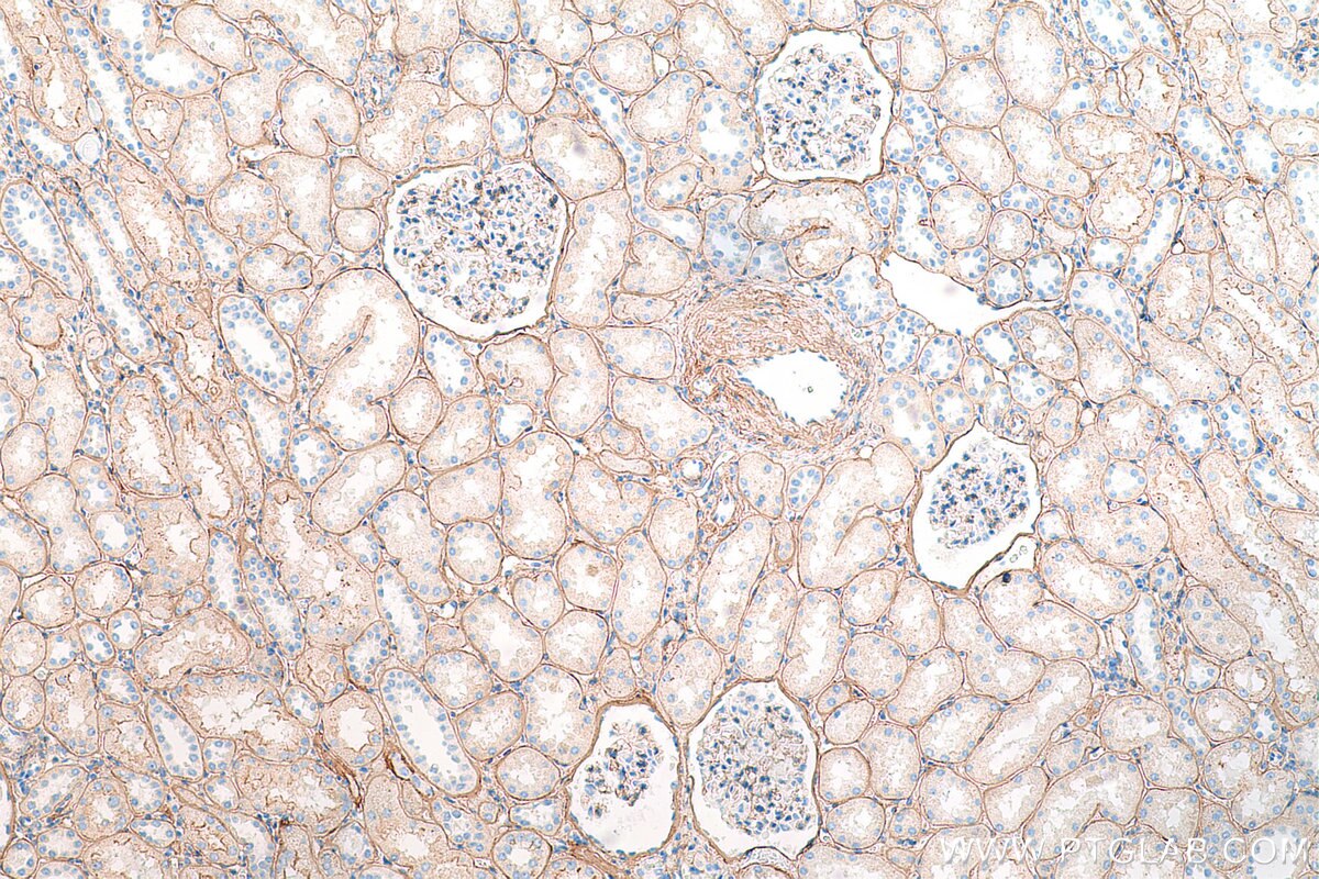 Immunohistochemistry (IHC) staining of human kidney tissue using COL4A2-specific Polyclonal antibody (55131-1-AP)