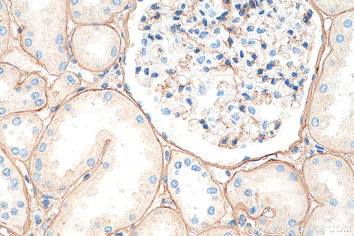 Immunohistochemistry (IHC) staining of human kidney tissue using COL4A2-specific Polyclonal antibody (55131-1-AP)