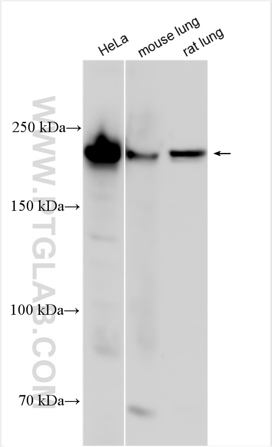 Western Blot (WB) analysis of various lysates using COL4A2-specific Polyclonal antibody (55131-1-AP)