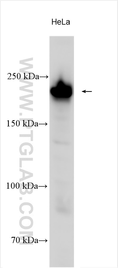 Western Blot (WB) analysis of various lysates using COL4A2-specific Polyclonal antibody (55131-1-AP)