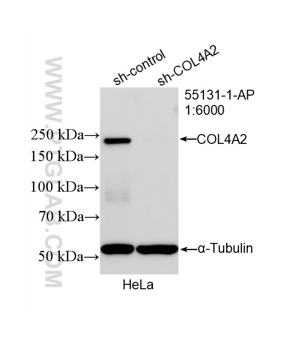 WB analysis of HeLa using 55131-1-AP Western Blot (WB) analysis of HeLa cells using COL4A2 Polyclonal antibody (55131-1-AP)