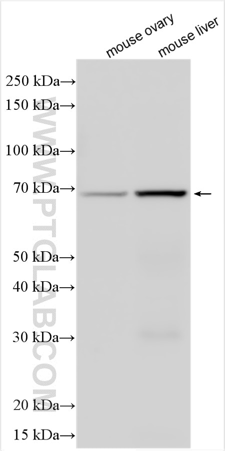 Western Blot (WB) analysis of various lysates using Collagen Type IX Polyclonal antibody (24148-1-AP)