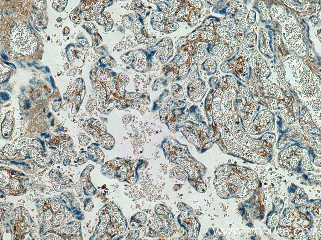 Immunohistochemistry (IHC) staining of human placenta tissue using Collagen Type V Polyclonal antibody (28382-1-AP)
