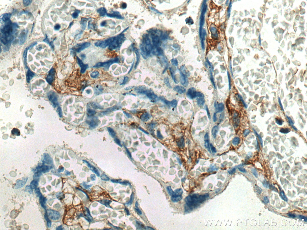 Immunohistochemistry (IHC) staining of human placenta tissue using Collagen Type V Polyclonal antibody (28382-1-AP)