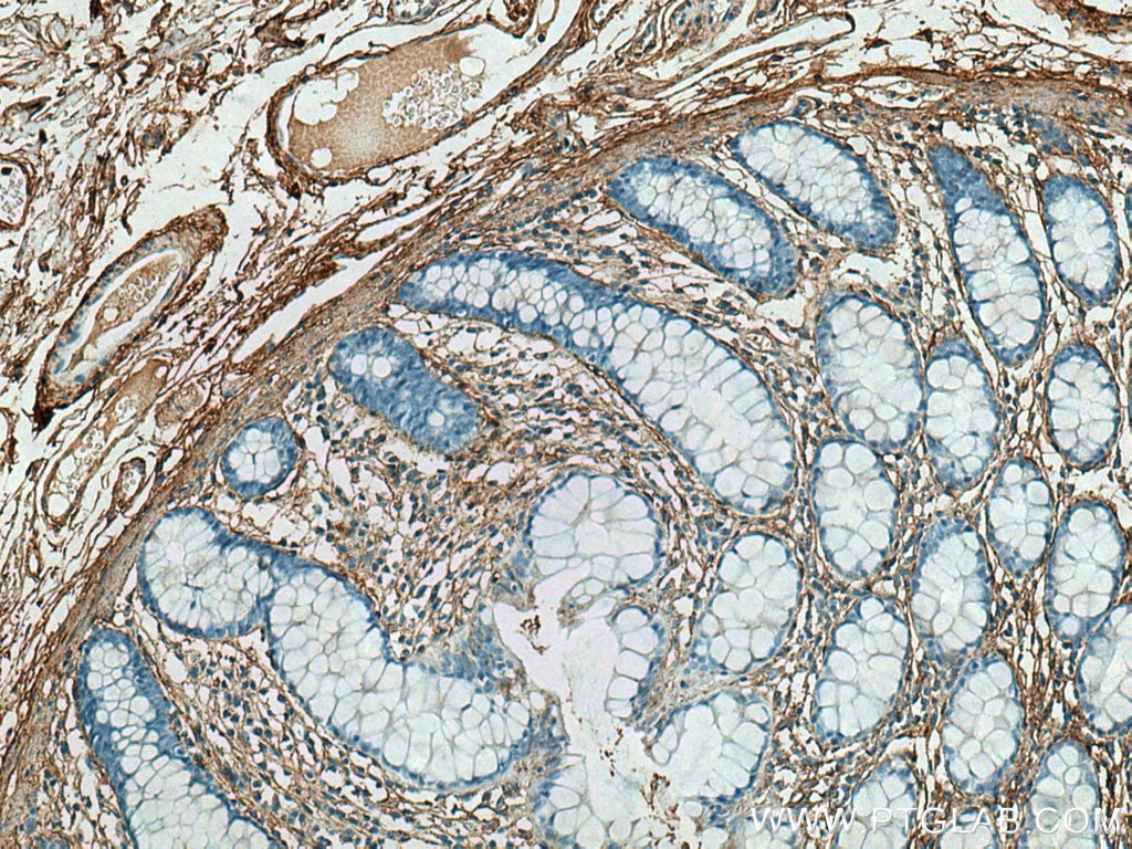 Immunohistochemistry (IHC) staining of human colon tissue using Collagen Type V Polyclonal antibody (28382-1-AP)