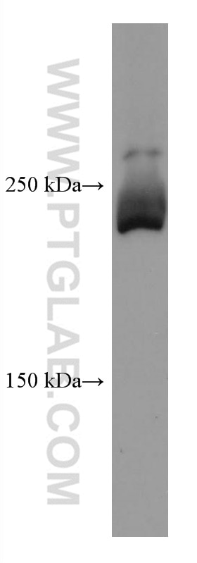 Western Blot (WB) analysis of mouse colon tissue using Collagen Type V Monoclonal antibody (67604-1-Ig)