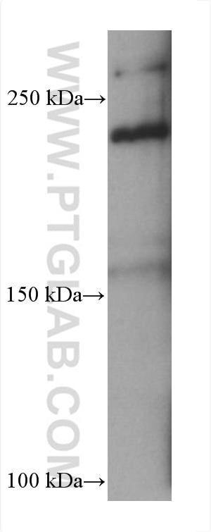 Western Blot (WB) analysis of HeLa cells using Collagen Type V Monoclonal antibody (67604-1-Ig)