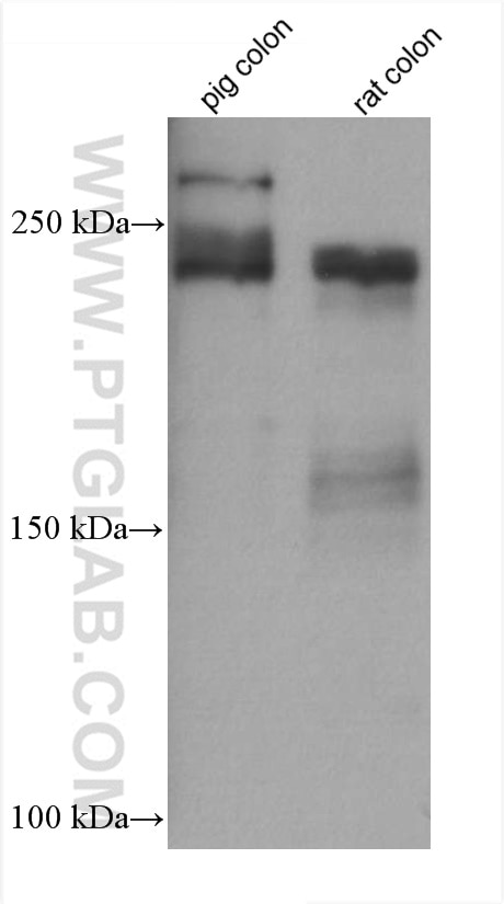 Western Blot (WB) analysis of various lysates using Collagen Type V Monoclonal antibody (67604-1-Ig)
