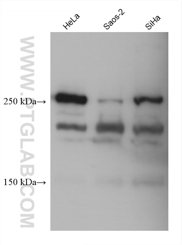 Western Blot (WB) analysis of various lysates using Collagen Type V Monoclonal antibody (67604-1-Ig)