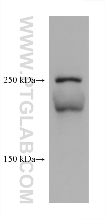 Western Blot (WB) analysis of various lysates using Collagen Type V Monoclonal antibody (67604-1-Ig)