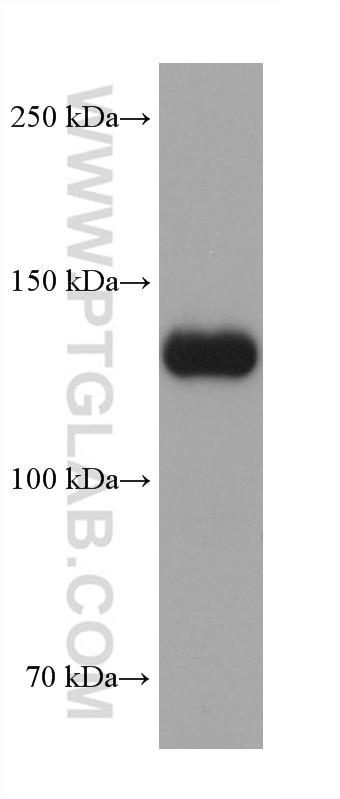 Western Blot (WB) analysis of human placenta tissue using COL6A2 Monoclonal antibody (68652-1-Ig)