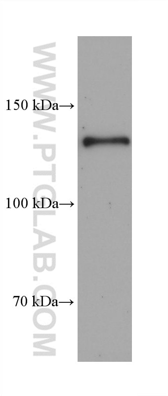 WB analysis of human heart using 68652-1-Ig