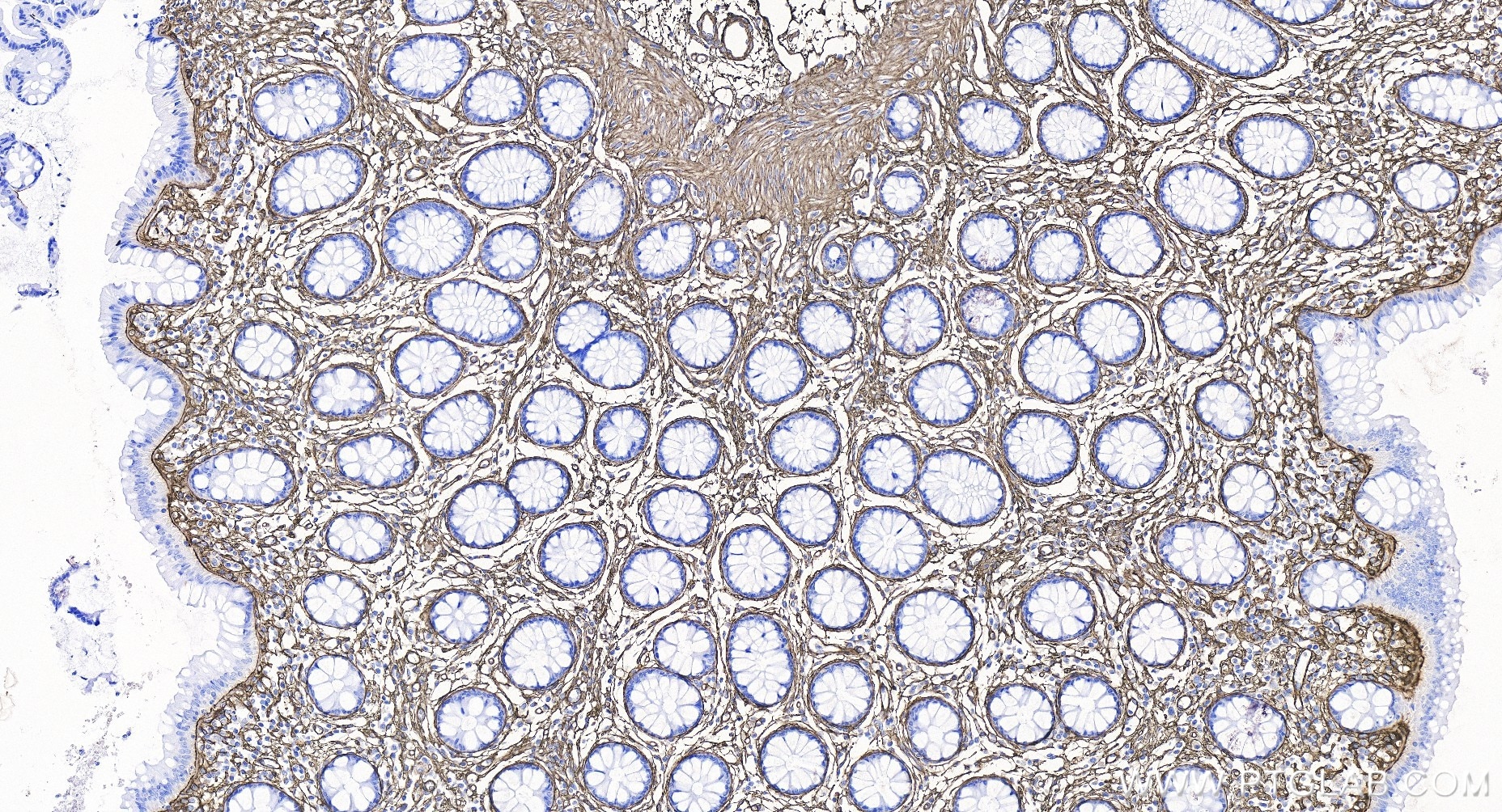 Immunohistochemistry (IHC) staining of human colon tissue using COL6A1 Recombinant antibody (85704-1-RR)