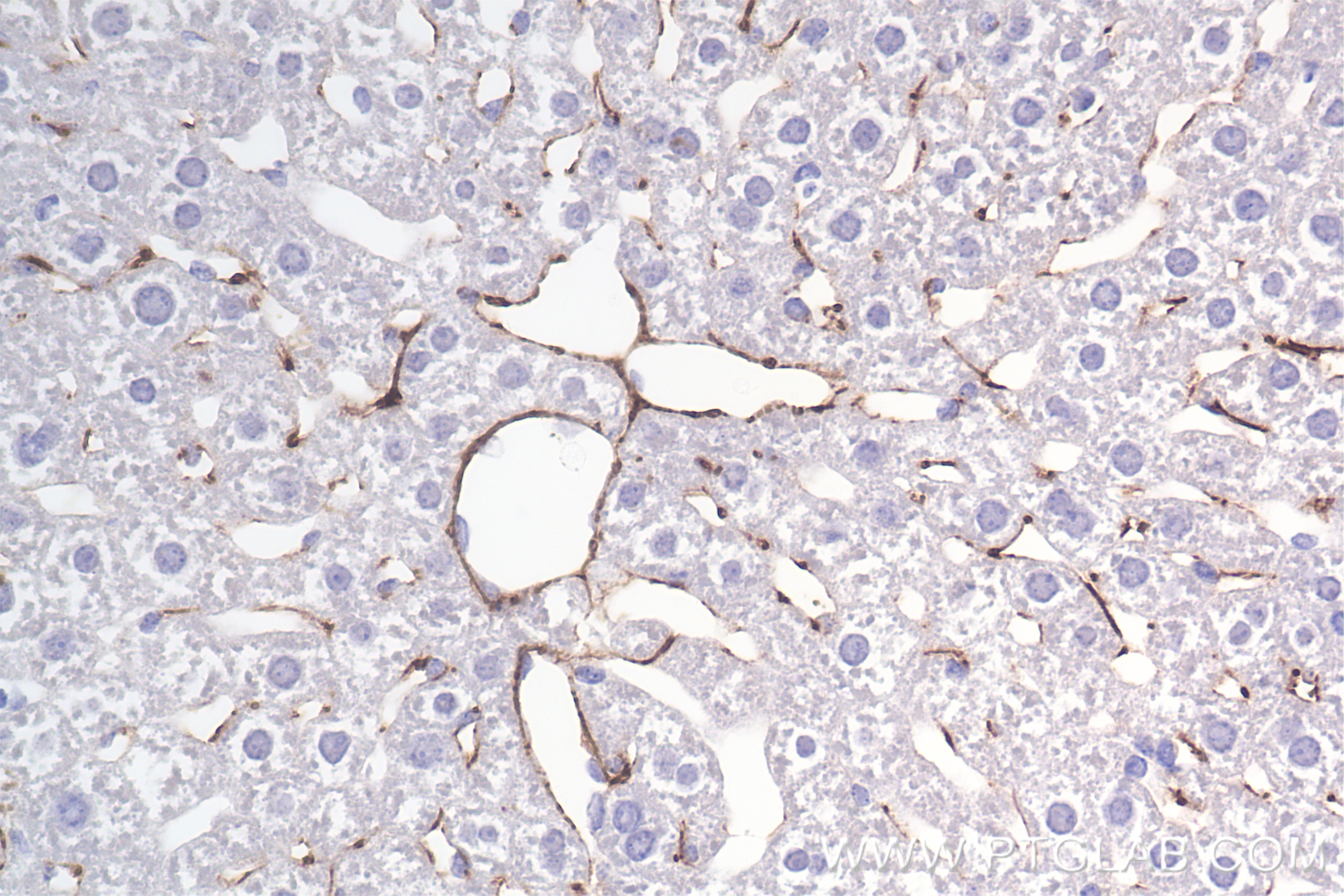Immunohistochemistry (IHC) staining of mouse liver tissue using COL6A1 Recombinant antibody (85704-1-RR)